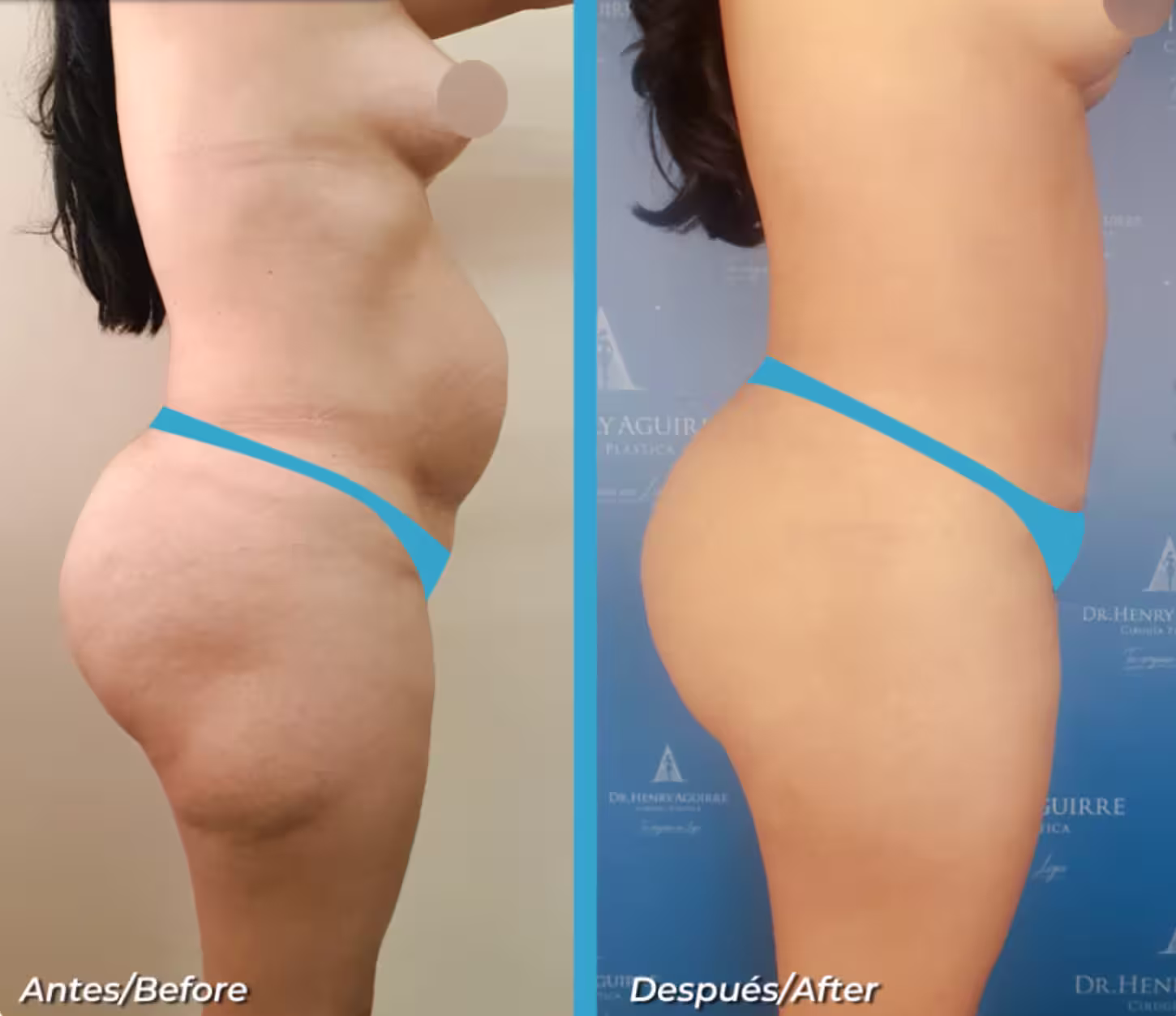 Imagen de Cirugia